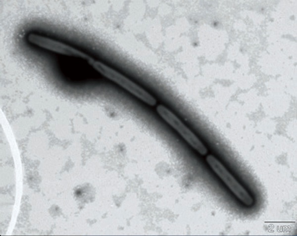 深海の微生物の顕微鏡写真